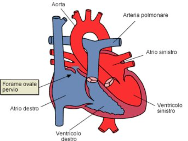 Forame Ovale Pervio Cardiaco (PFO) – Diagnosi ecocolor doppler transcranico